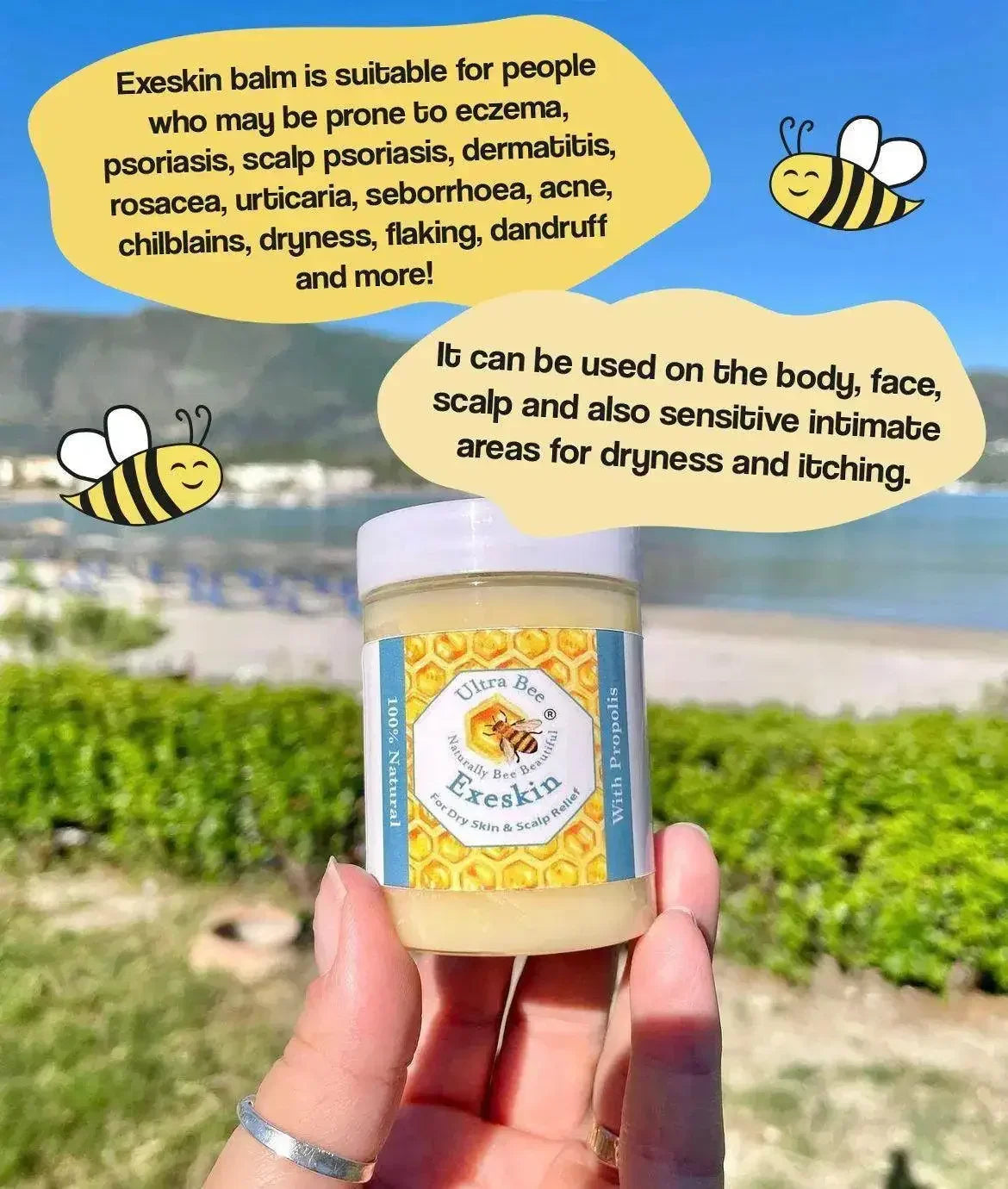 100% Natural Exeskin Balm - Dry Skin & Scalp - Ultra Bee Health UK