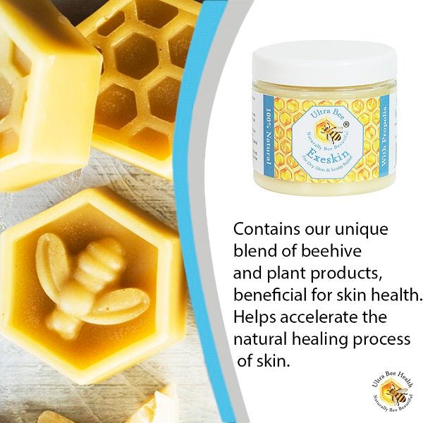 100% Natural Exeskin Dry Skin and Scalp Balm - Ultrabee