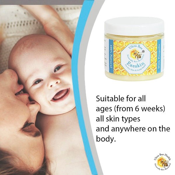100% Natural Exeskin Dry Skin and Scalp Balm - Ultrabee