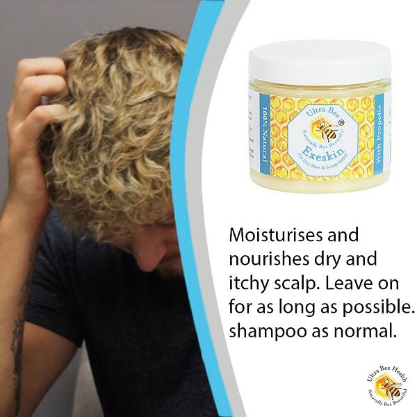 100% Natural Exeskin Dry Skin and Scalp Balm - Ultrabee