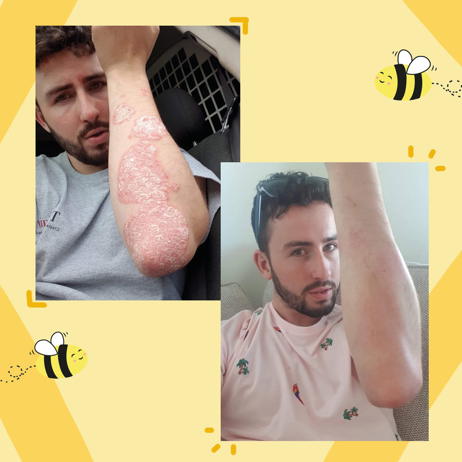 Ultra Bee customer review photo 1