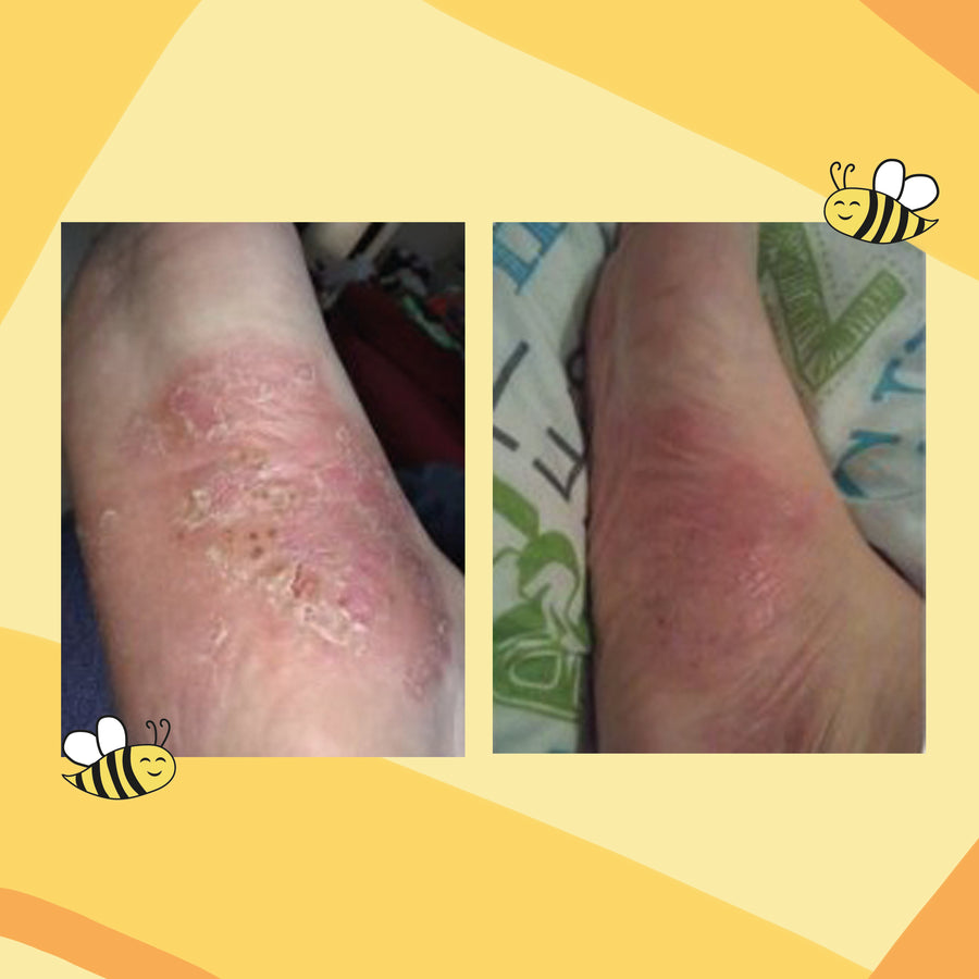 Ultra Bee customer review photo 13