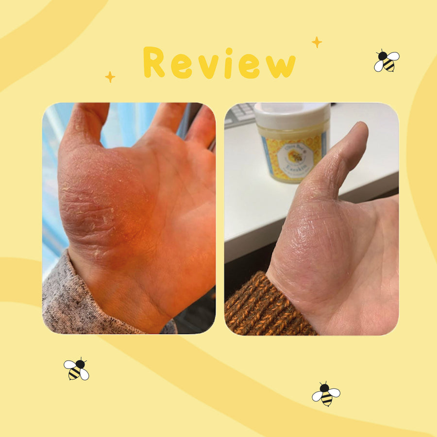 Ultra Bee customer review photo 9