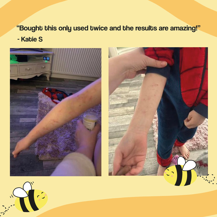 Ultra Bee customer review photo 10