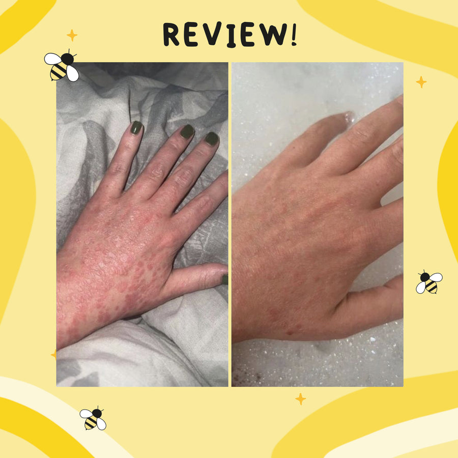 Ultra Bee customer review photo 12